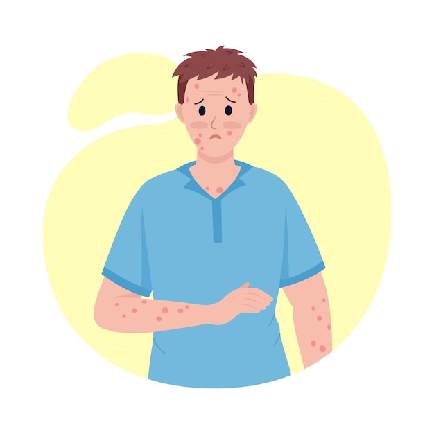 Man with skin rash semi flat color vector character. Posing figure. Full body person on white. Post covid syndrome isolated modern cartoon style illustration for graphic design and animation