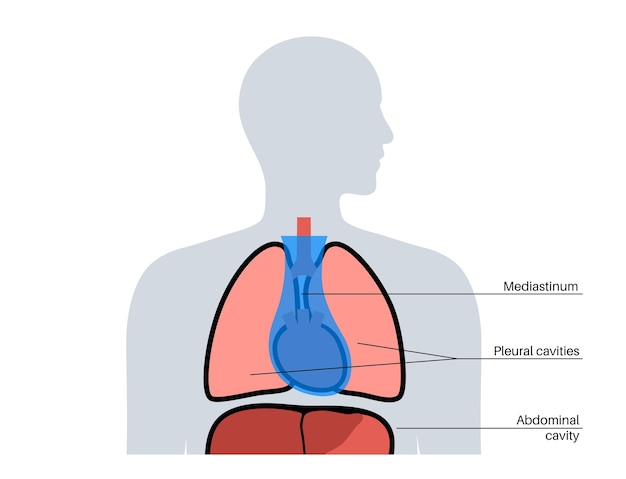 Mediastinum infographic poster