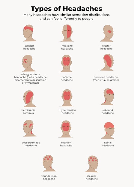 Vector medical infographictypes of headache medical poster and infographicneurology information