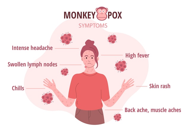 Monkey pox outbreak Infographics of virus symptoms in humans Vector illustration