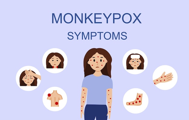 Monkey pox virus symptoms illustration with woman character Monkeypox outbreak concept