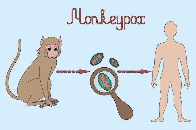 Monkey smallpox virus human human infection scheme with monkeypox virus in cartoon style