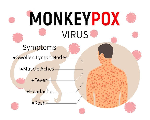 Monkeypox symptoms infographic Banner with text a silhouette of a monkey and a human body