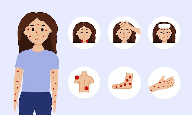 Vector monkeypox virus symptoms illustration with woman character monkeypox outbreak concept by world heal