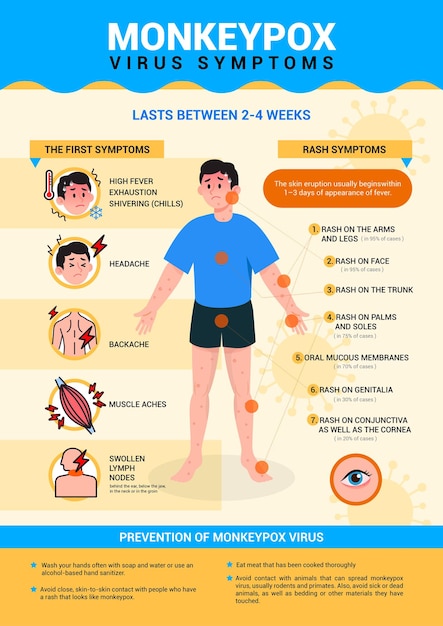 Monkeypox virus symptoms and prevention infographic poster vector design