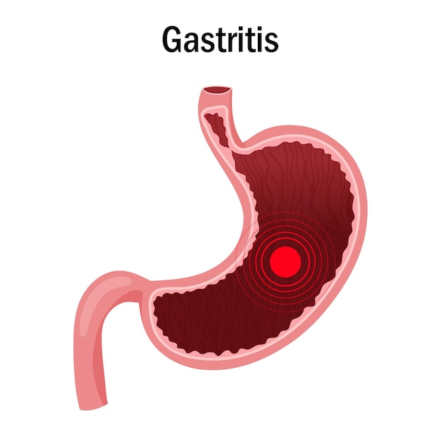 Vector pain or disease focus in stomach illustration