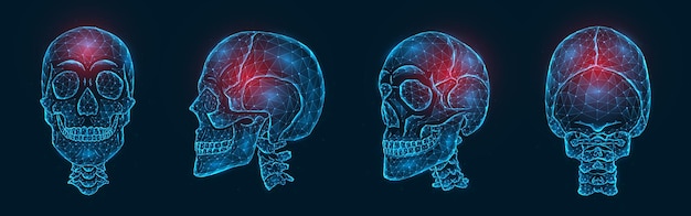 Pain, injury or inflammation of the skull bones polygonal  illustration. Low poly model of a human skull