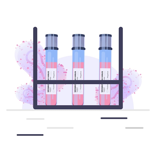 Pandemic Monkeypox outbreak. Blood sample tube for Monkeypox virus test in the laboratory.