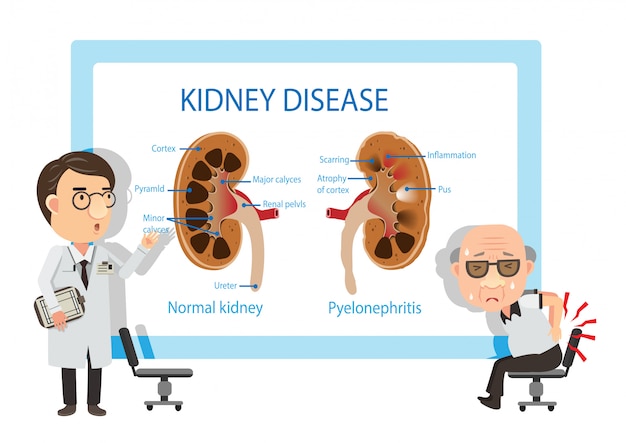 Patients and doctors Viewing diagrams Pyelonephritis