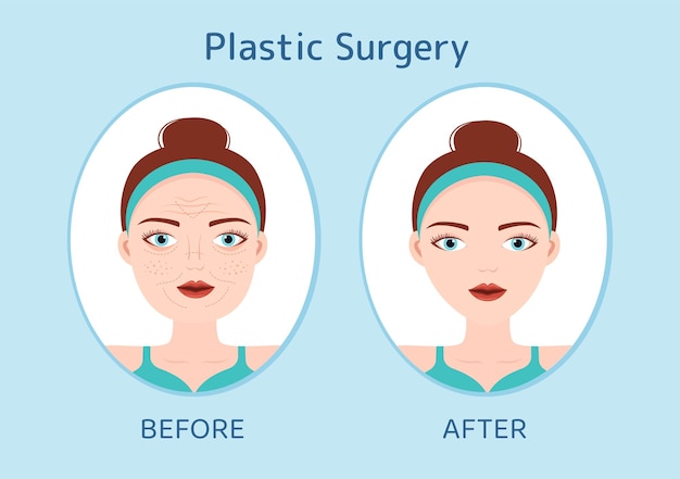 Plastic Surgery Flat Cartoon Illustration of Medical Surgical Operation on the Body or Face