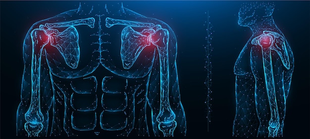 Polygonal   illustration of a painful shoulder joint. Shoulder joint disease. Diseases of the human musculoskeletal system