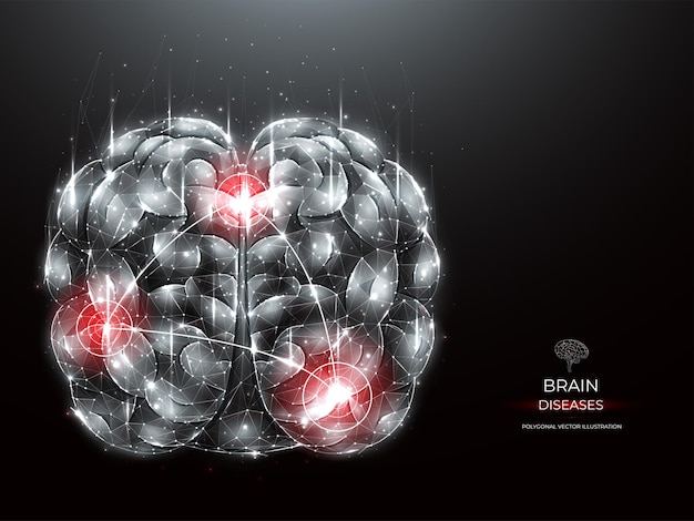 Polygonal vector illustration of human brain inflammatory disease