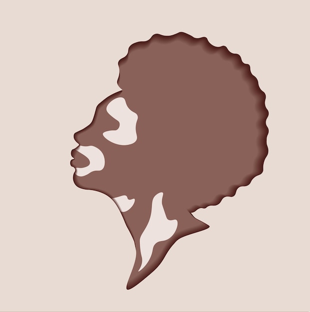 Profile of an African American woman with vitiligo disease. Cut Out Trend illustration style.