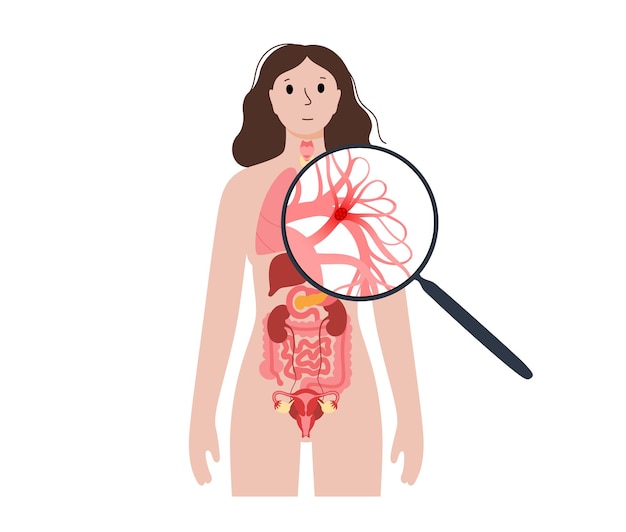 Pulmonary embolism disease