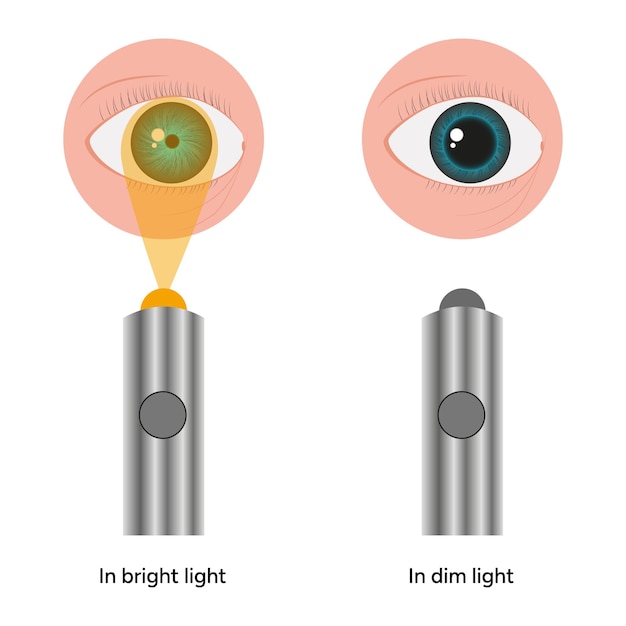 Vector pupil size changes by refraction eye ophthalmology medical illustration