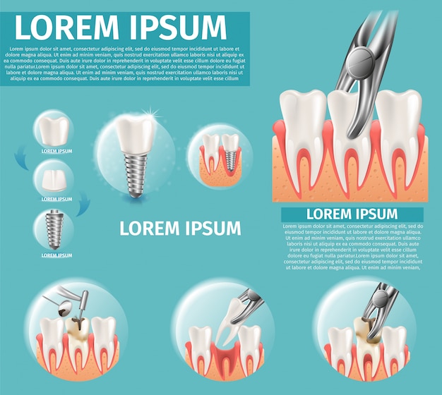 Realistic Illustration Infographic Dental Surgeron