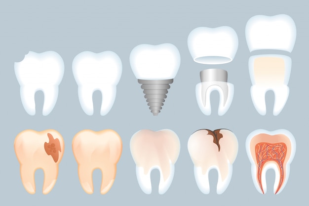 Realistic Tooth Structure Illustration