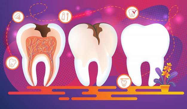 Row of Teeth with Dental Problems