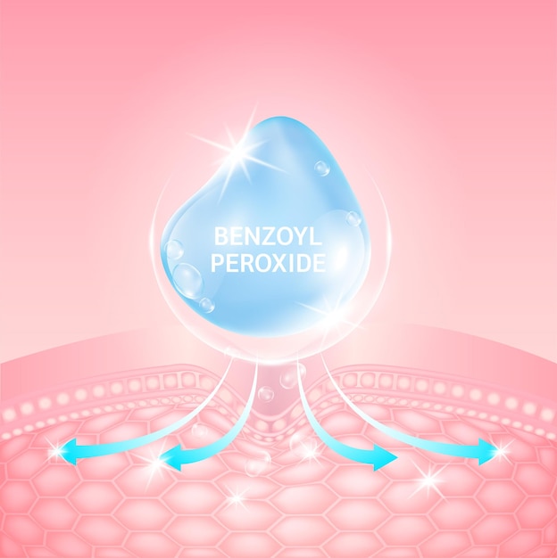 Serum Benzoyl Peroxide blue. Collagen Hyaluronic acid. Helps dissolve clogged acne.