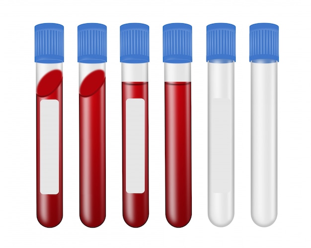 Set of empty and full blood test tubes with or without label