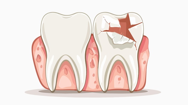 Vector sick damaged human tooth on white background