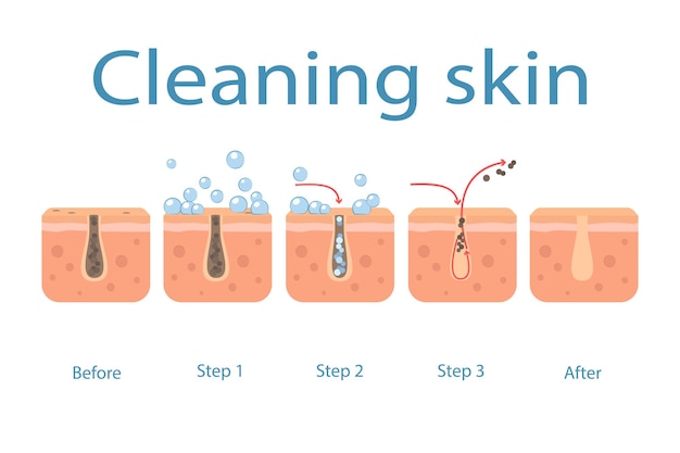 Skin cleaning steps on clogged face facial skin care pore cleaning