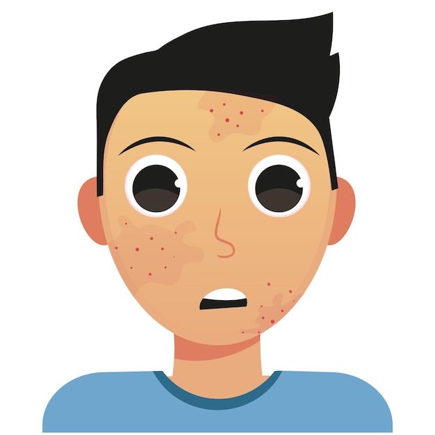 Skin Problem, young man, acne vector