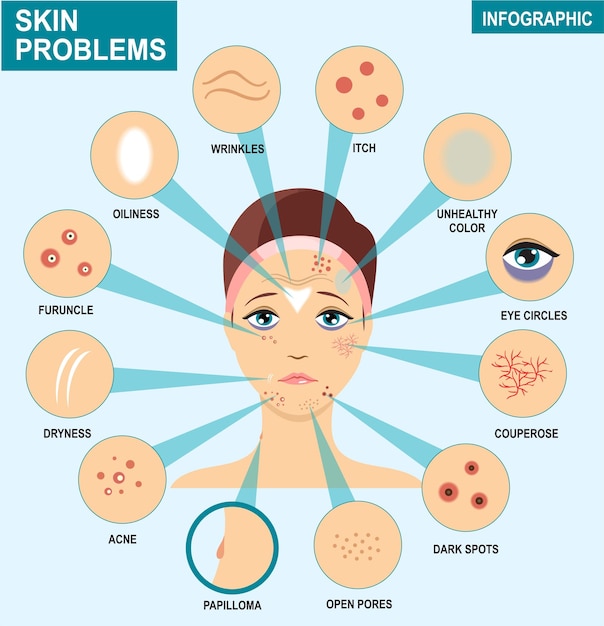 Skin problems infographics Woman and set of the most common skin problems should take care of acne