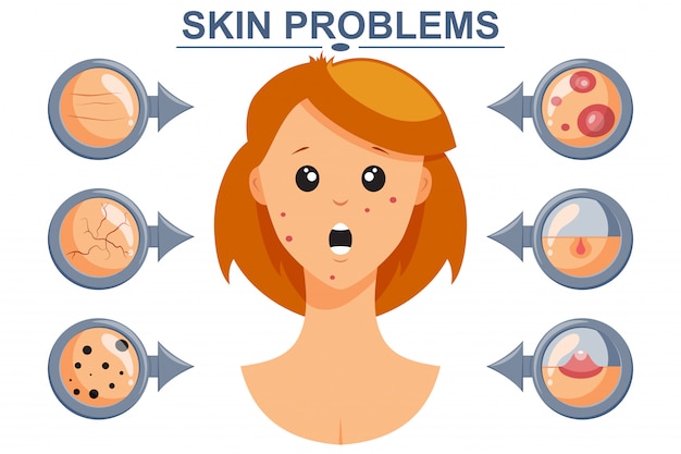 Skin problems vector infographics