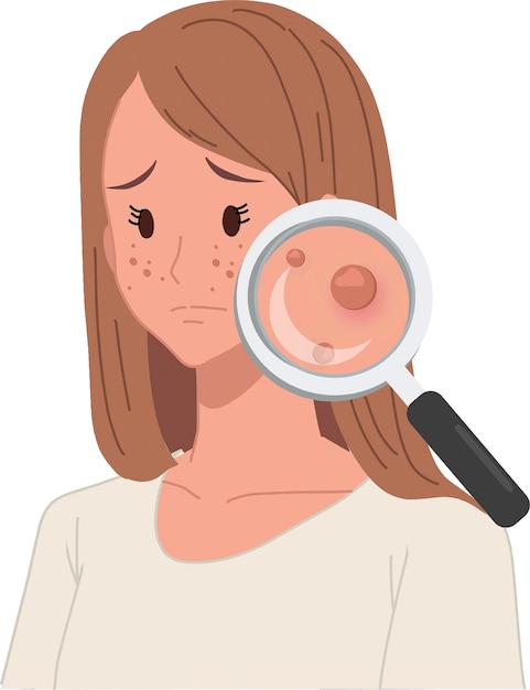 Skincare and Beauty Female Face Battling Acne Medical Vector Image