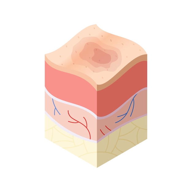 Skincare medical concept Problems in crosssection of human skin horizontal layers structure Anatomy illustrative model