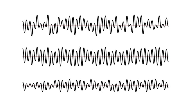 Sound wave signals set. Black audio track beats diagram collection. Voice or music sample concept.