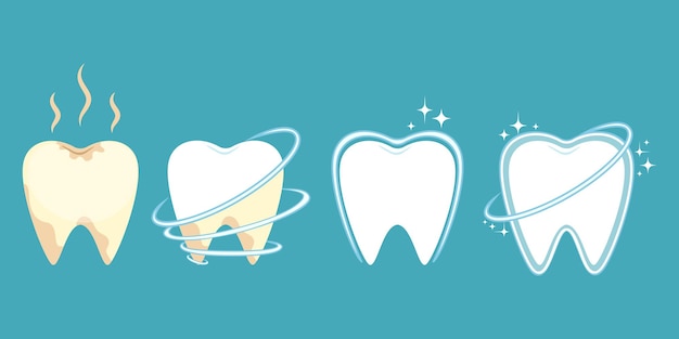 Stages of cleaning and whitening teeth