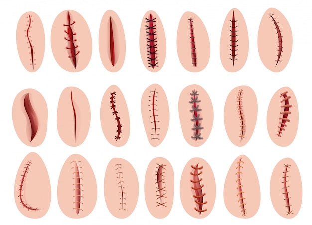 Suture set, cartoon style