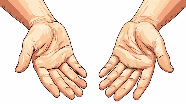 Vector swollen hands cartoon stock illustration