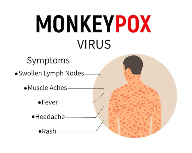 Symptoms of monkeypox Disease infographic Text and man with rash and ulcers on the body Symptoms