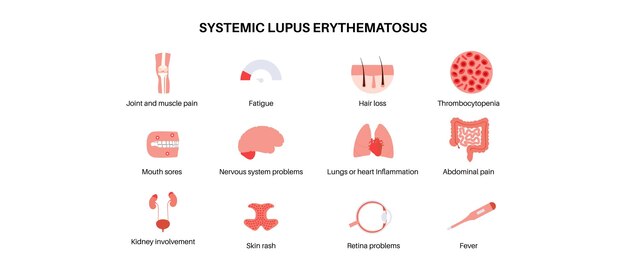 Vector systemic lupus erythematosus