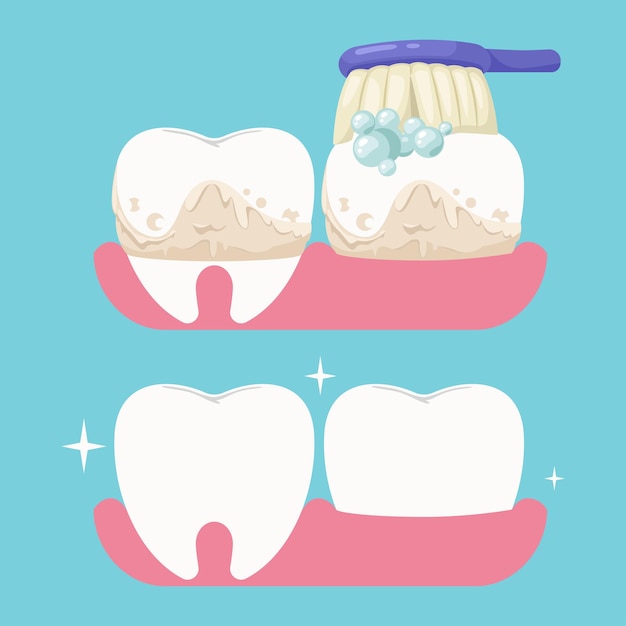 Teeth cleaning in cartoon style.