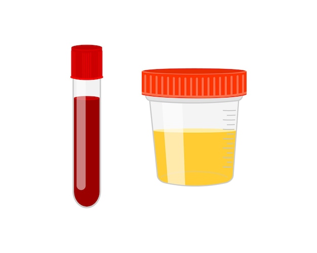 Test tube with blood and urine sample container Urinalysis blood medical analysis