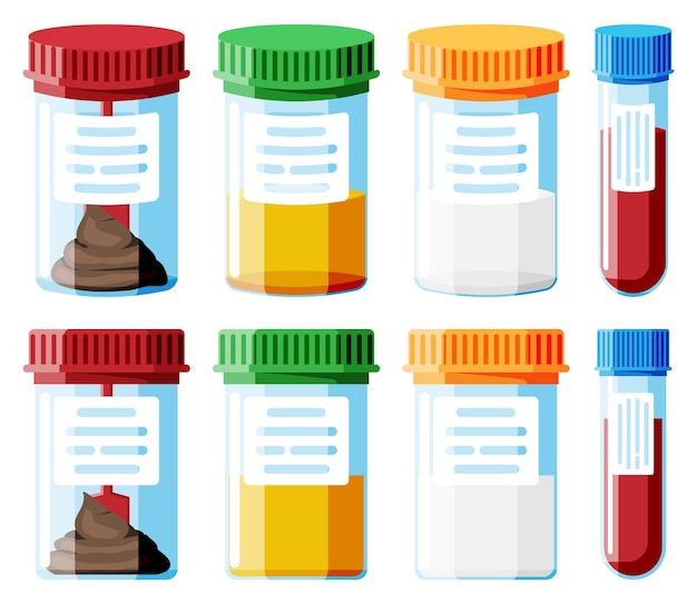 Test Tubes with Caps Stool Blood Urine Sperm