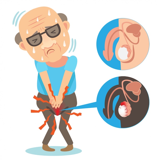 Testicular Pain illustration