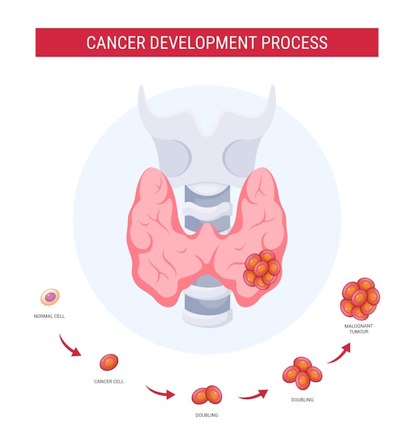 Thyroid cancer development process