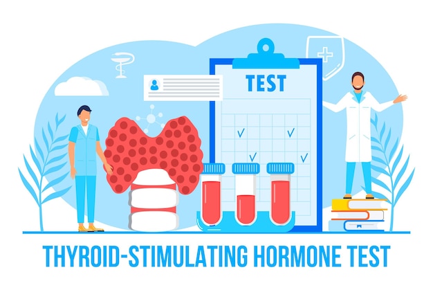 Thyroidstimulating hormone test concept vector for medical website Hypothyroidism concept vector Endocrinologists diagnose and treat human thyroid gland Specialists make blood test hormones