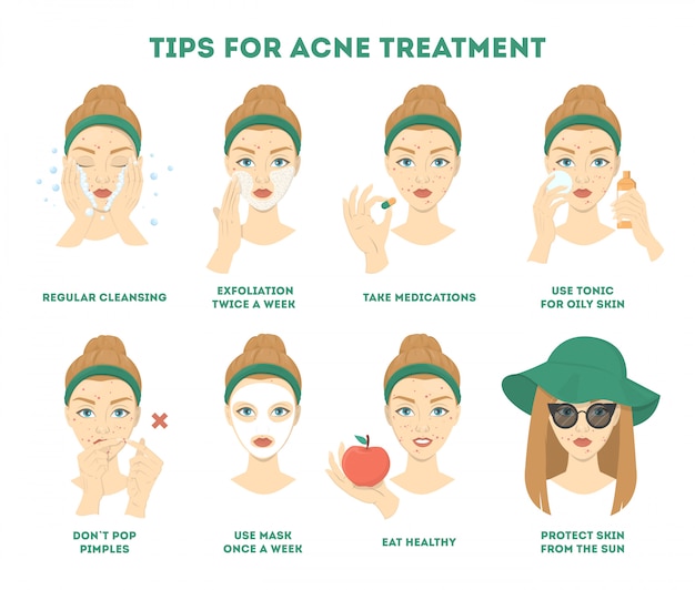 Tips for acne treatment. How to get a clear face instruction.