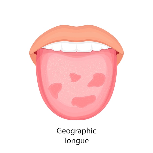 Tongue disease organs concept vector