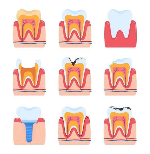 Tooth dentistry dental teeth oral toothache isolated on white medical hygiene design in style cartoon vector illustration