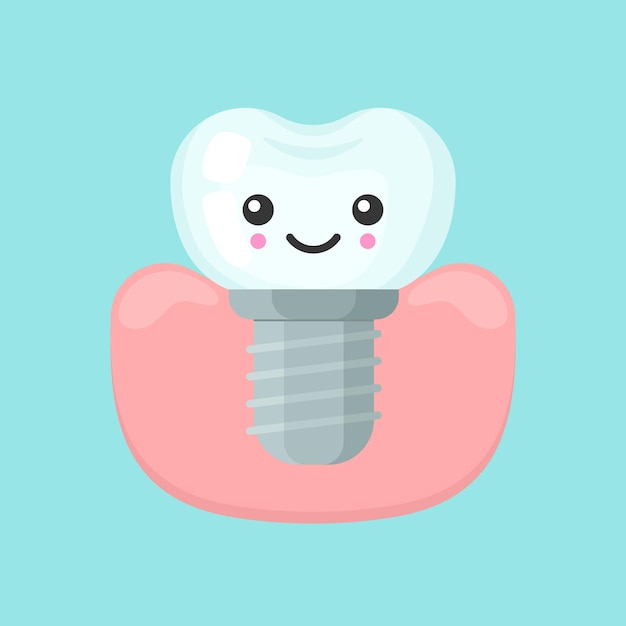 Tooth implantation stomatology vector illustration Cute colorful teeth implant