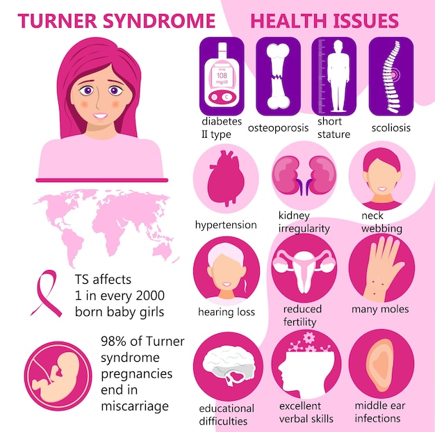 Turner Syndrome infographic vector. Signs, health issues are shown. Short stature, kidney irregularity, reduced fertility, many moles, osteoporosis and diabetes are main problems. TS awareness month.