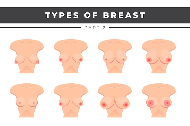 Types of Breast Vector illustration Breast Anatomy