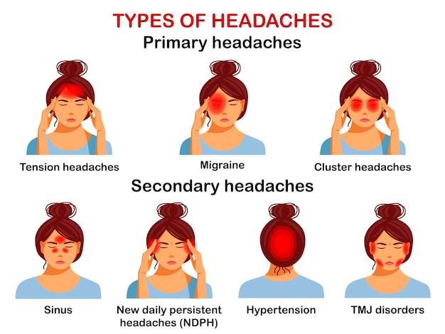 Vector types of headaches vector infographic